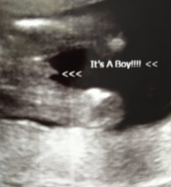 Is this definitely a girl?