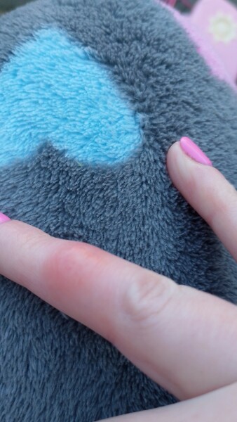 I'm going to cut my hand off!!!?