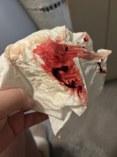 Ftm brown when I wipe 8 weeks
