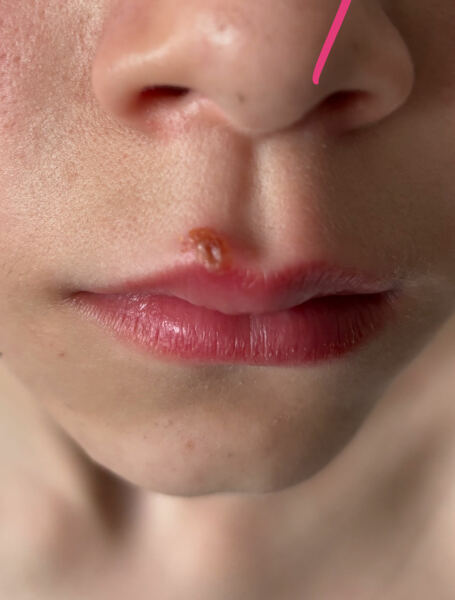 How accurate was the pharmacist, do you think?