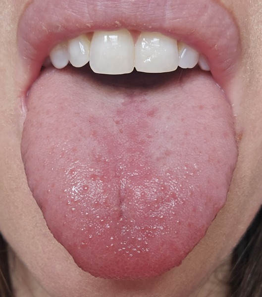 What's wrong with my tongue?