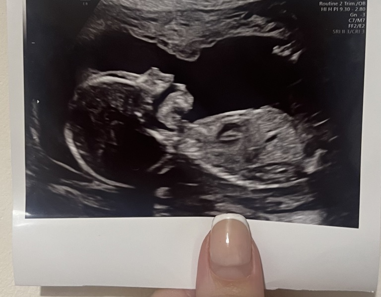 11DPO positive - but concerned