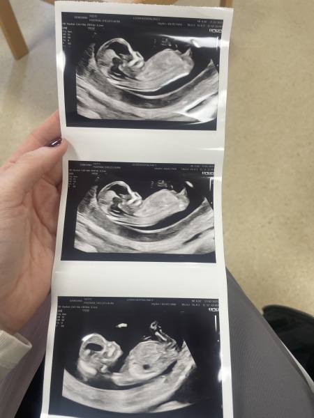 Boy or girl?