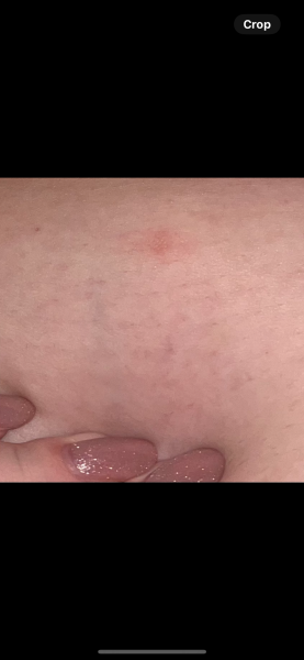 Is this melanoma?? Handhold needed
