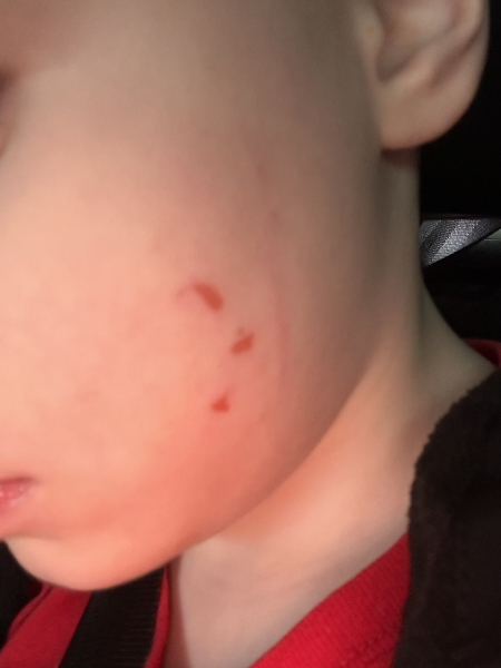 Could this leave a scar?