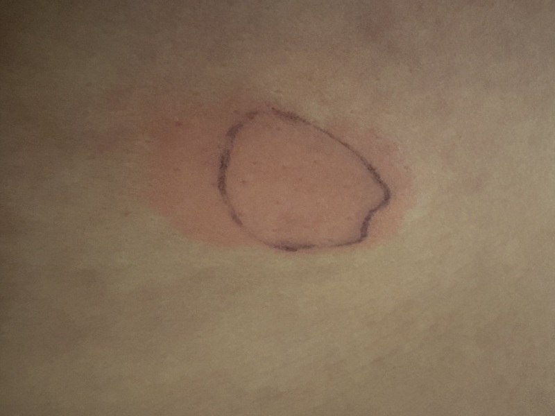 March 2025 starters thread 2