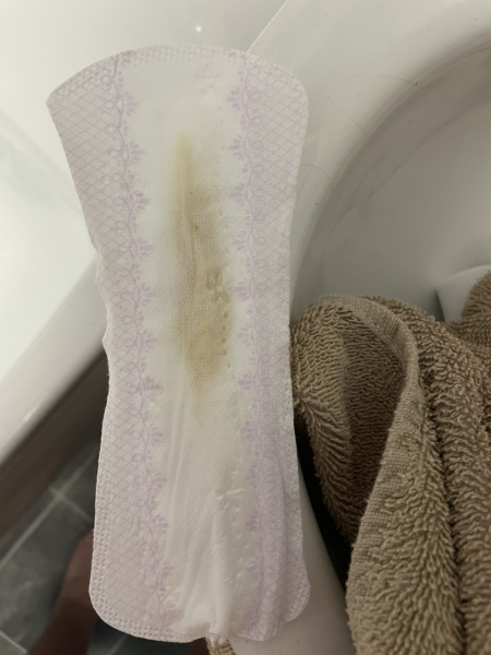 Yellow discharge 34 weeks