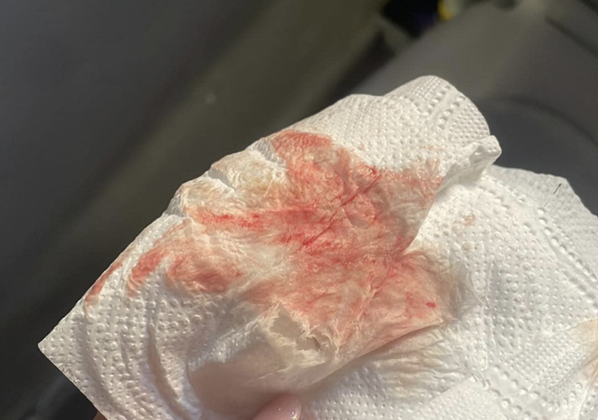 Positive tests but bleeding