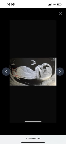 Looking for advice