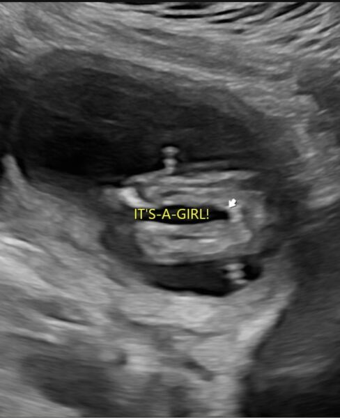 Due September 2025 part 2
