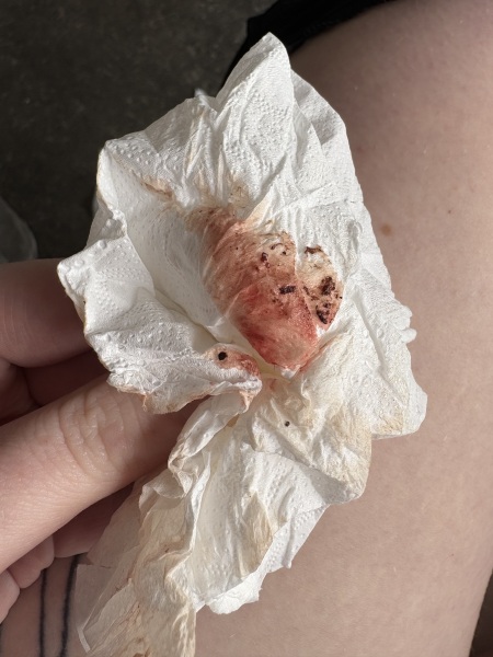 Help needed for bleeding