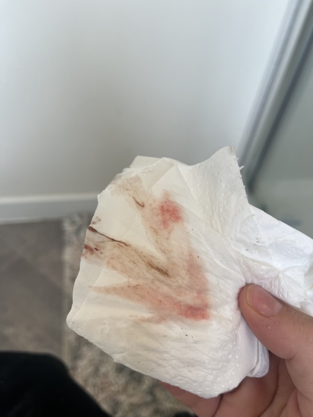 Is this a miscarriage?