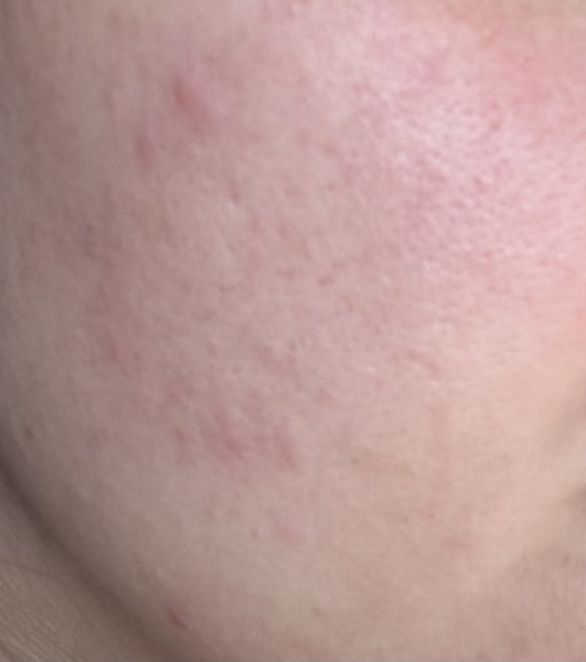 Fancy skincare doesn’t help. Why does my skin looks like this?