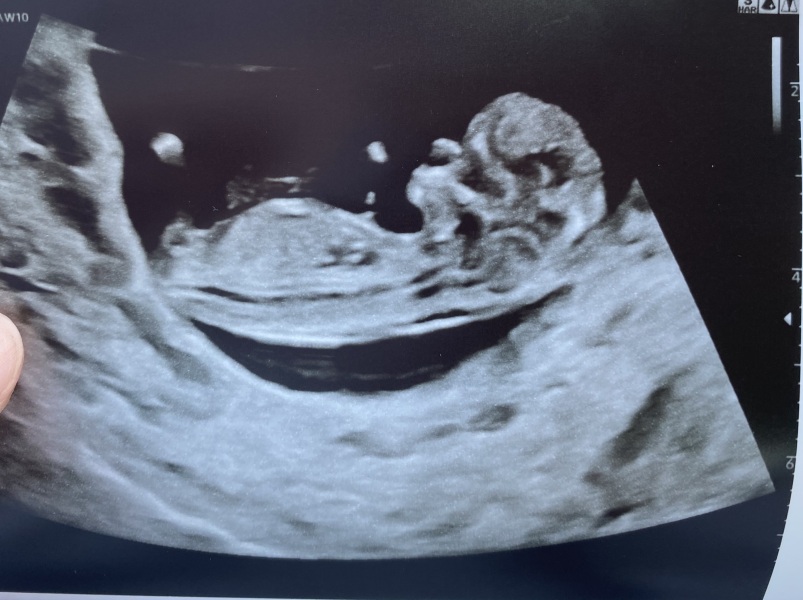 Due in October - anyone else?