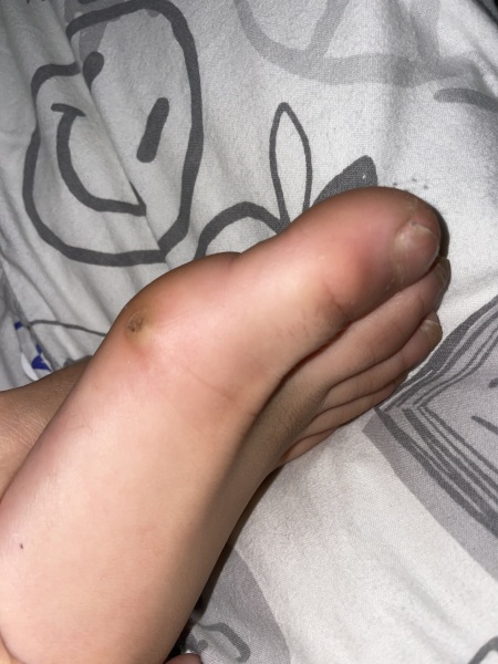 What on earth is this on DS's foot?