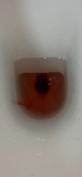 Miscarriage?