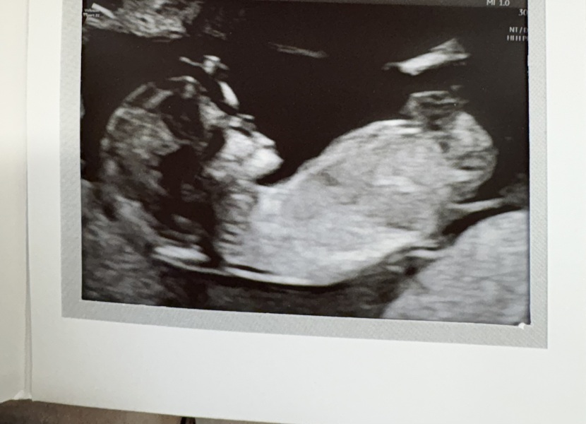 12 week 5 days scan, boy or girl??