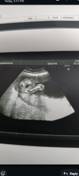gender prediction