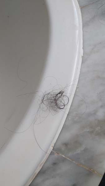 To think losing this amount of hair every day just when brushing isn't normal?