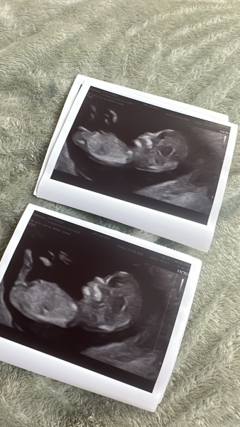 Skull Theory..Boy or Girl?