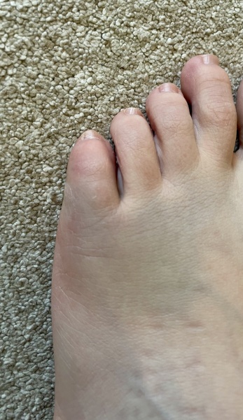 Minor injuries or home with Captain Birdseye?