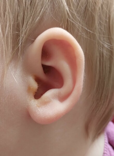 Is this an ear infection? Photo included
