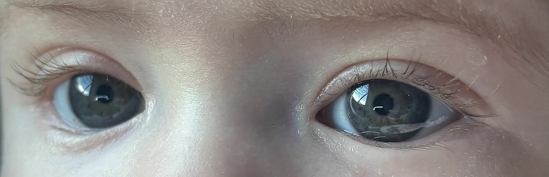 What eye colour?