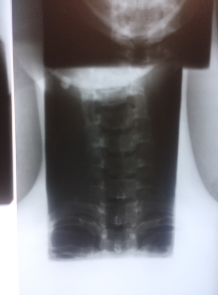 What's this on my x-ray?