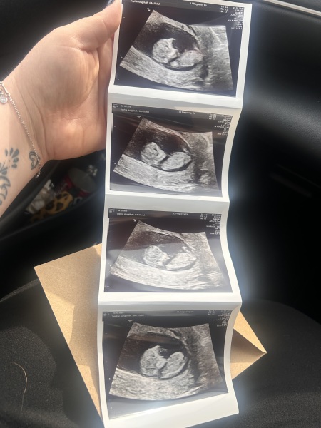 Boy or girl