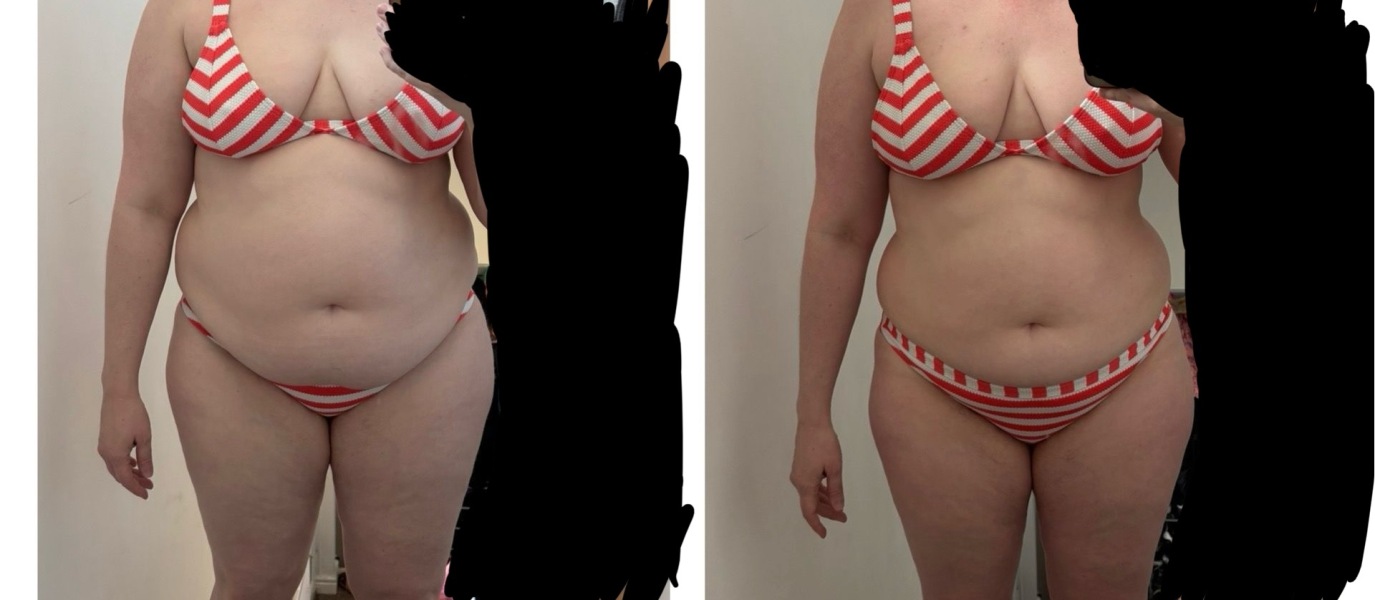 March 2025 starters thread 2