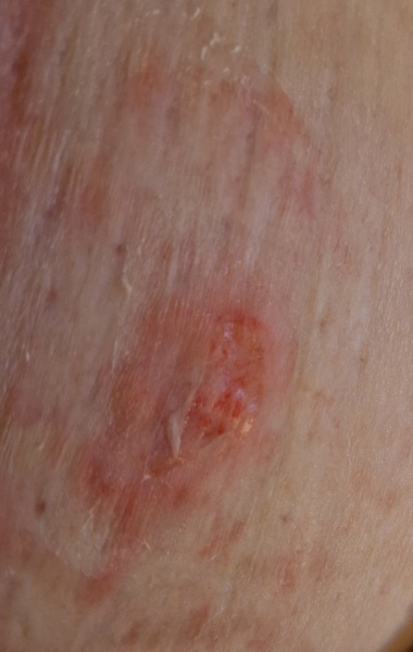 Random raw skin thing - ideas?