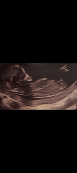 Guessing gender