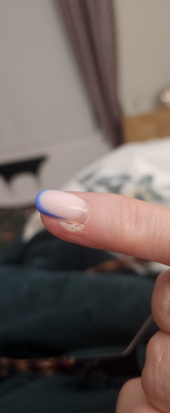 Is this a little wart or something else growing?