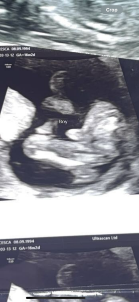 Baby scan