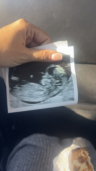 Bit of fun - boy or girl?