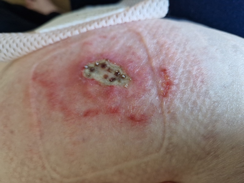 Random raw skin thing - ideas?