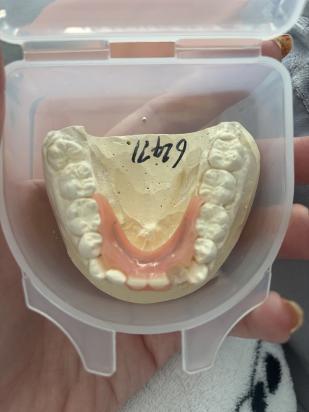 Denture phobia