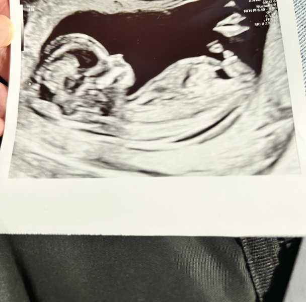 Girl or boy?