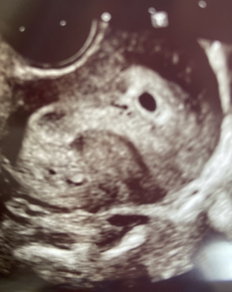 Scan advice