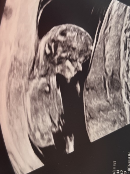 Boy or girl