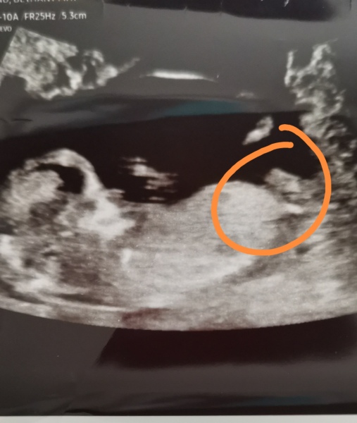Nub theory- Gender!