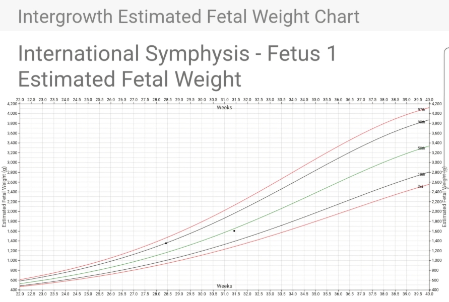 May Babies 2025 - Thread 2
