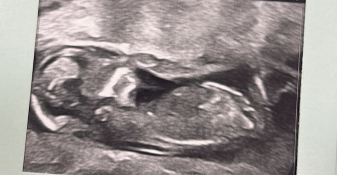12 week scan gender guesses?