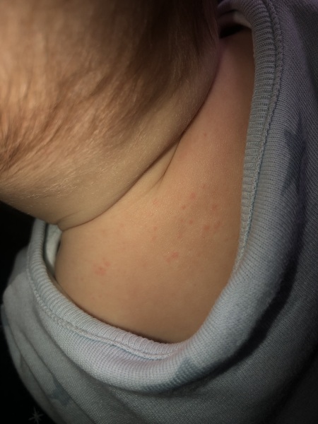 6 month old has red spots ? What are these spots??