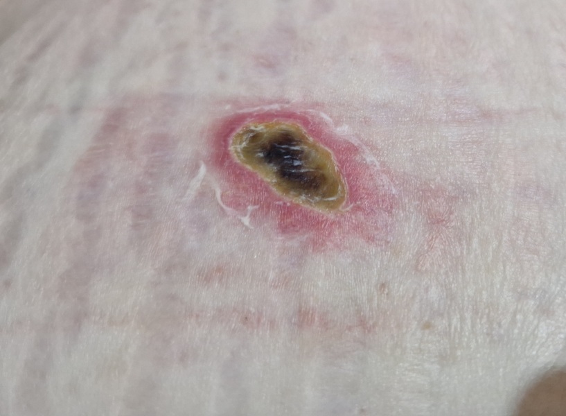 Random raw skin thing - ideas?