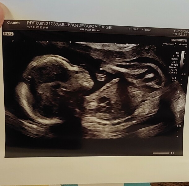 Girl or boy?