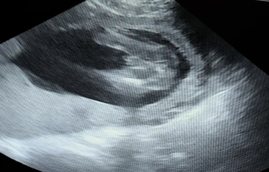 Boy or girl? 17w
