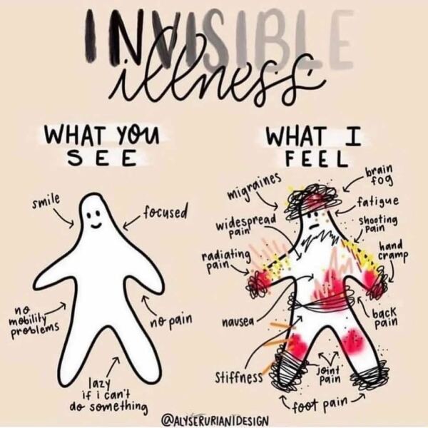 Fibromyalgia - be honest.