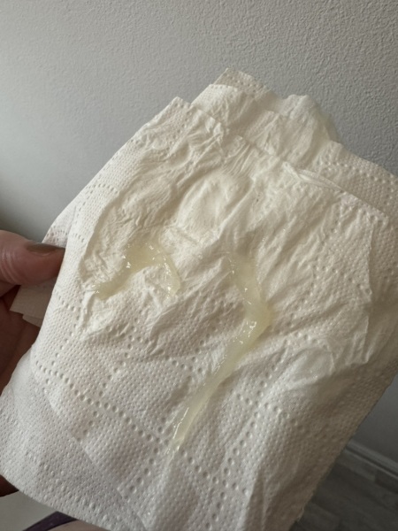 Is this my mucus plug? TMI PHOTO