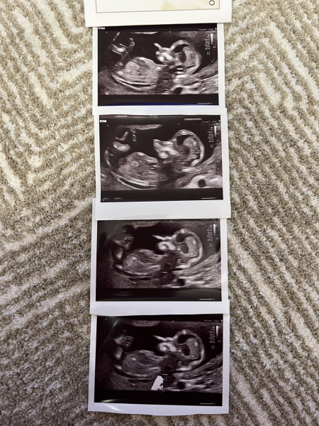 Due September 2025 part 2